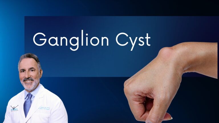 Dr. Badia explains what are Ganglion cyst