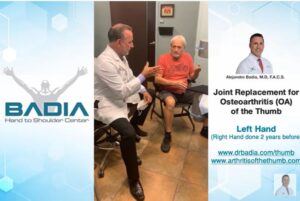 Sustitución articular para la osteoartritis (OA) del pulgar