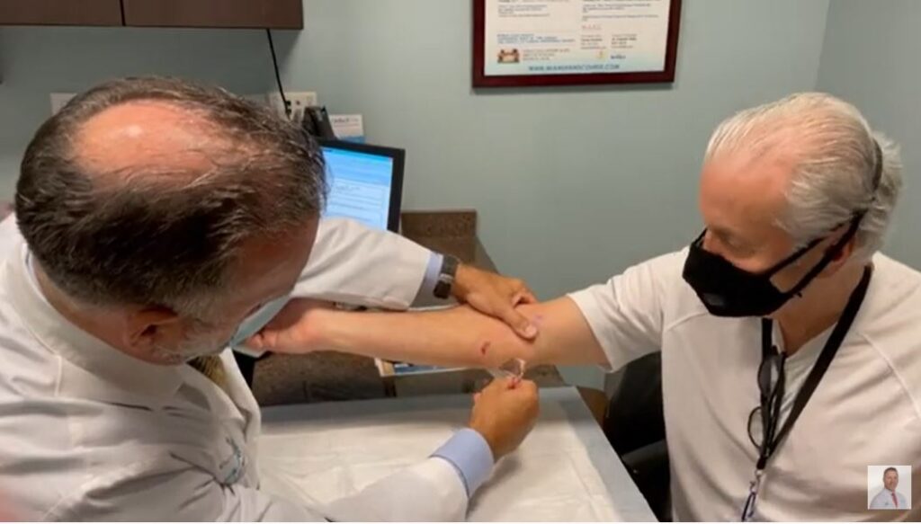 tenex cirugia de codo