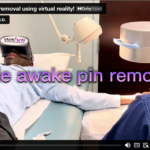 wide awake pin removal with vr