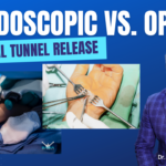 Liberación endoscópica versus abierta del túnel carpiano