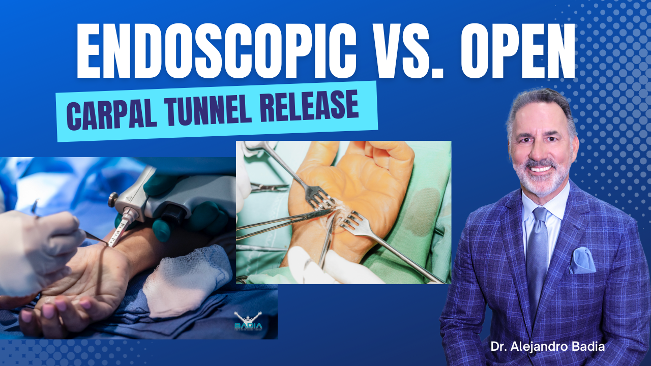 Endoscopic vs open carpal tunnel release
