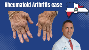 Caso de artritis reumatoide