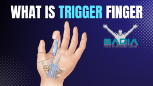 What is Trigger finger?