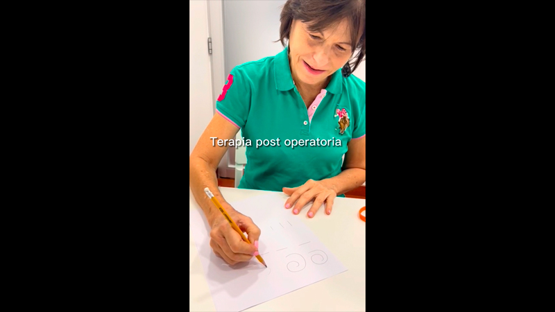 En este video pueden ver una artroplastia total de la articulacion trapecio-metacarpiana. Esta es una de las opciones que ofrecemos en nuestro centro ortopedico para el diagnostico de rizartrosis. Para mas informacion visite nuestra pagina web originaldrbad.wpengine.com