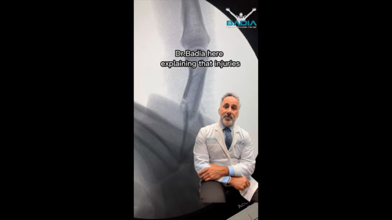 Dr.Badia Explains Finger Fractures & Why They Should Be Taken Seriously!