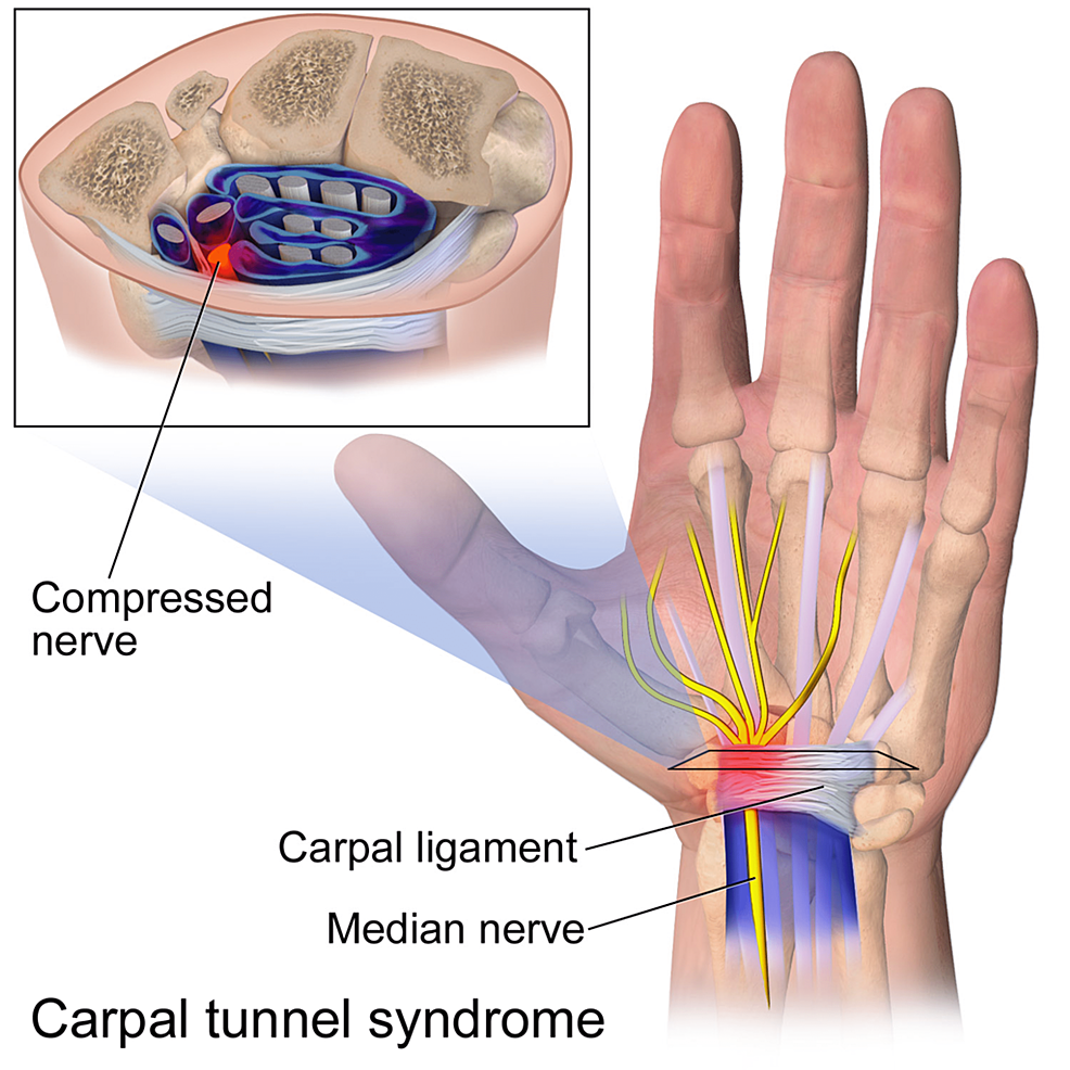 anatomía del túnel carpiano