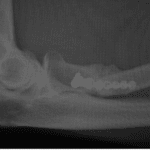 proximal radial head fracture xray of plating