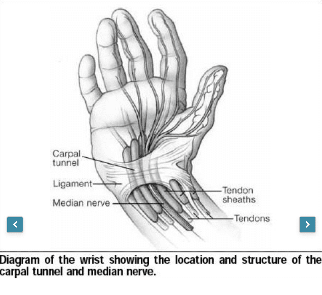 Surgical Procedure for Carpal Tunnel Syndrome