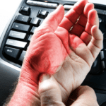 síndrome del túnel carpiano , mano en el teclado con el dedo rojo afectado por la enfermedad