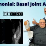A. Miller cmc artritis de la articulación basal