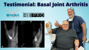 A. Miller cmc basal joint arthritis