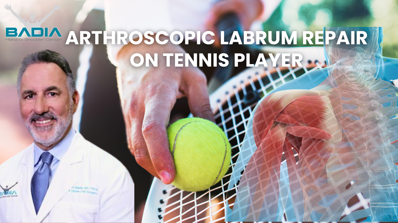 Arthroscopic labrum repair on tennis player