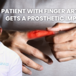 prosthetic implant for finger arthritis