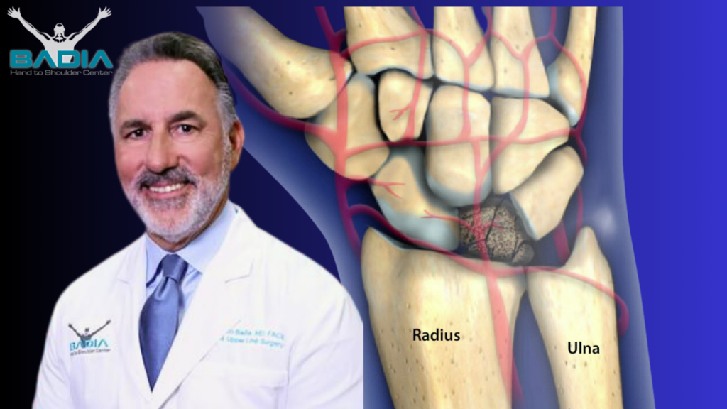 Kienbocks disease best wrist surgeon