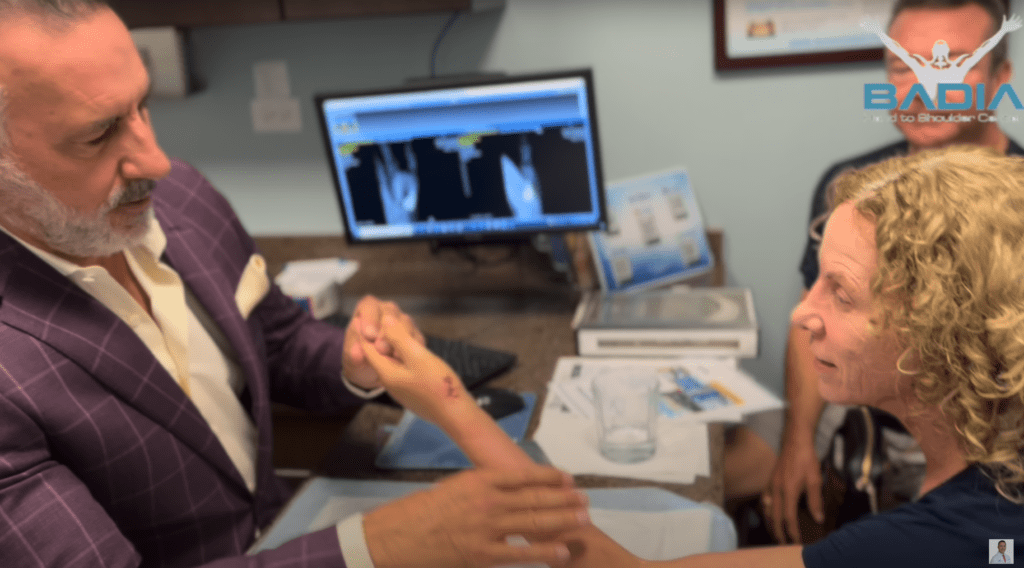 After visiting 4 physicians this patient found a solution for her basal joint #arthritis