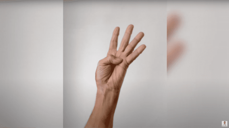 78 Year Old Male Shares His Results 7 Days Post Thumb Carpometacarpal Joint Hemiarthroplasty.