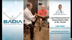 Sustitución articular para la osteoartritis (OA) del pulgar