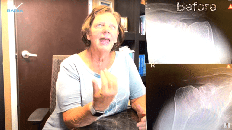 both shoulders replaced