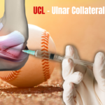 Ligamento colateral cubital en jugador de béisbol resuelto con inyección por el Dr. Badia