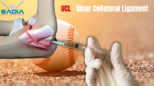 Ulnar collateral ligament in baseball player resolved with injection by Dr. Badia