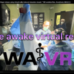 liberación del túnel carpiano en realidad virtual completamente despierto