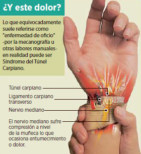 Dolor de mano
