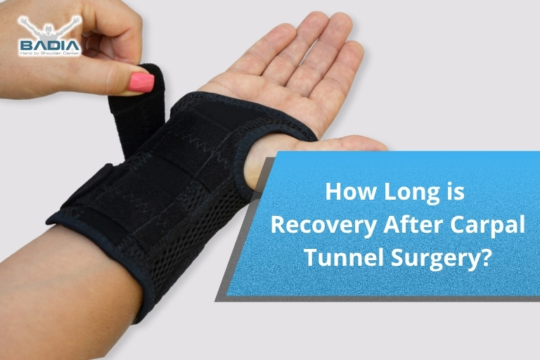 How Long is Recovery After Carpal Tunnel Surgery?