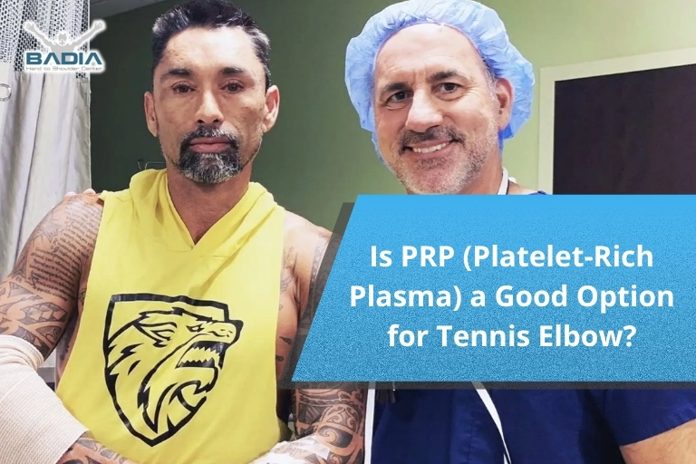 Is PRP (Platelet-Rich Plasma) a Good Option for Tennis Elbow?