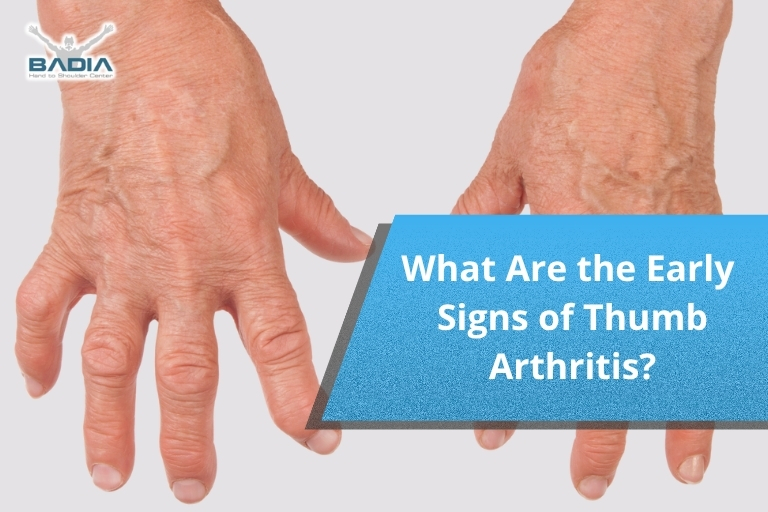 What Are the Early Signs of Thumb Arthritis?