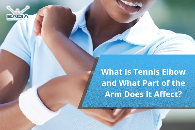 What Is Tennis Elbow and What Part of the Arm Does It Affect?