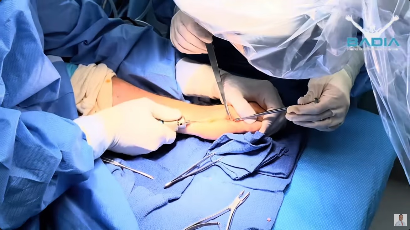 Did you know you can be stay awake for surgery with virtual reality ?!