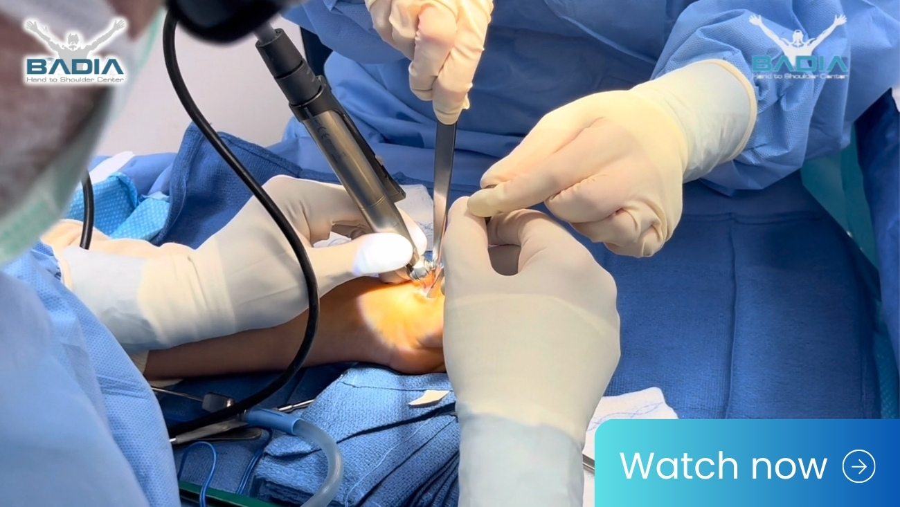 How much bone is removed during a thumb joint replacement procedure?