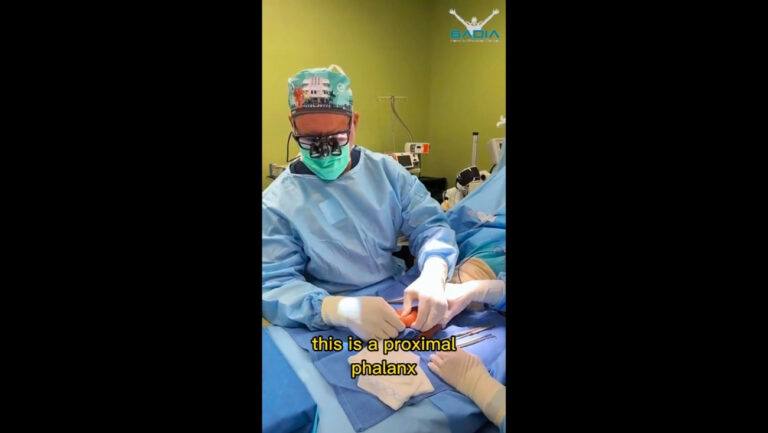 Live surgery malunion of index finger