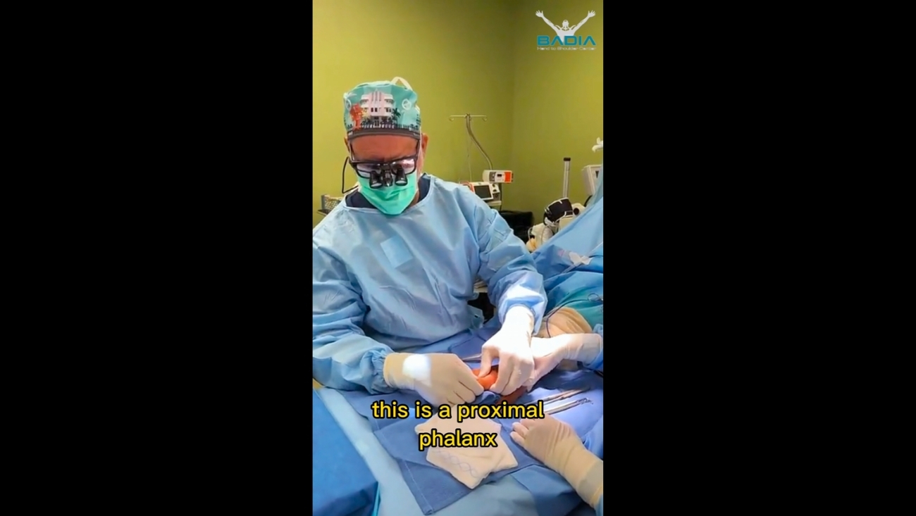 Live surgery malunion of index finger