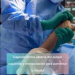 Pacient has rigidity in the thumb and does move after capsulectomy