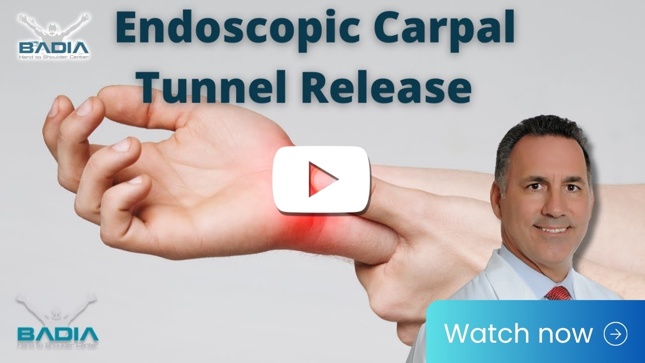 Endoscopic carpal tunnel release with Dr. Badia