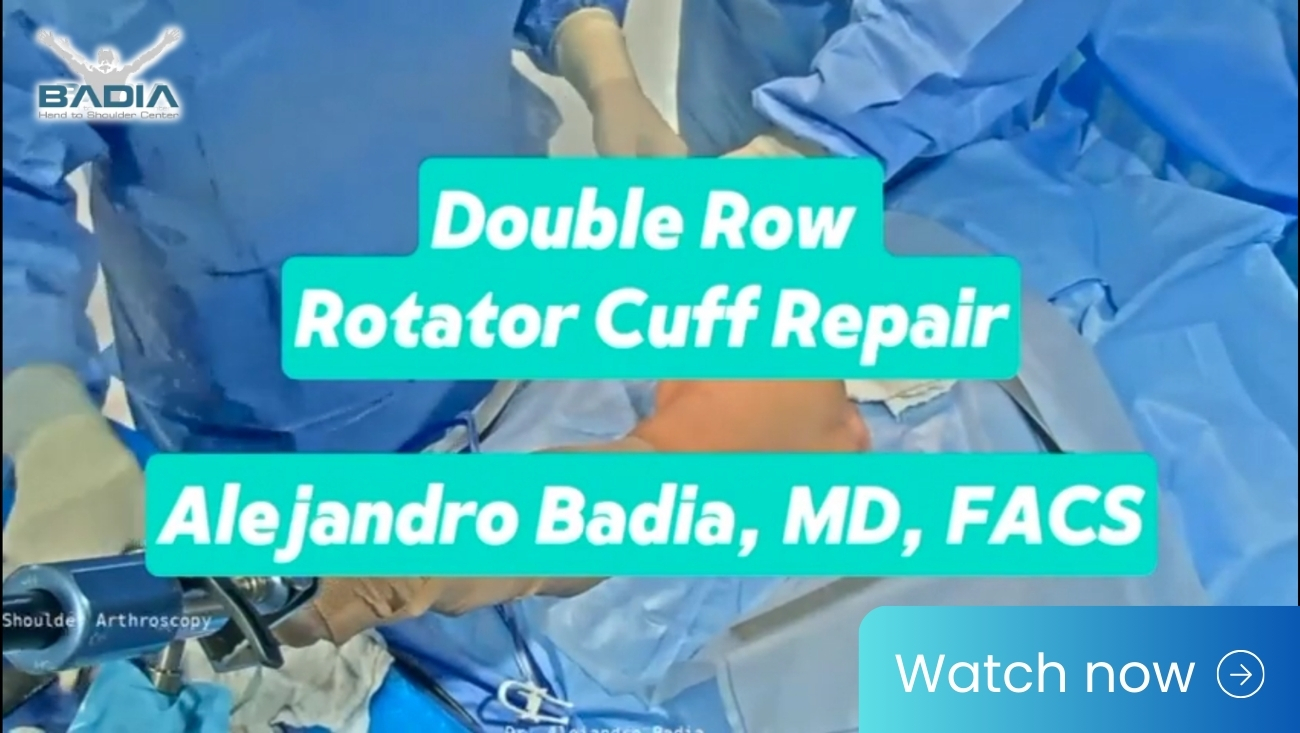 Double Row Rotator Cuff Repair