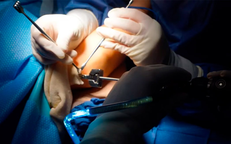 slider-drbadia-republica-dominicana-04