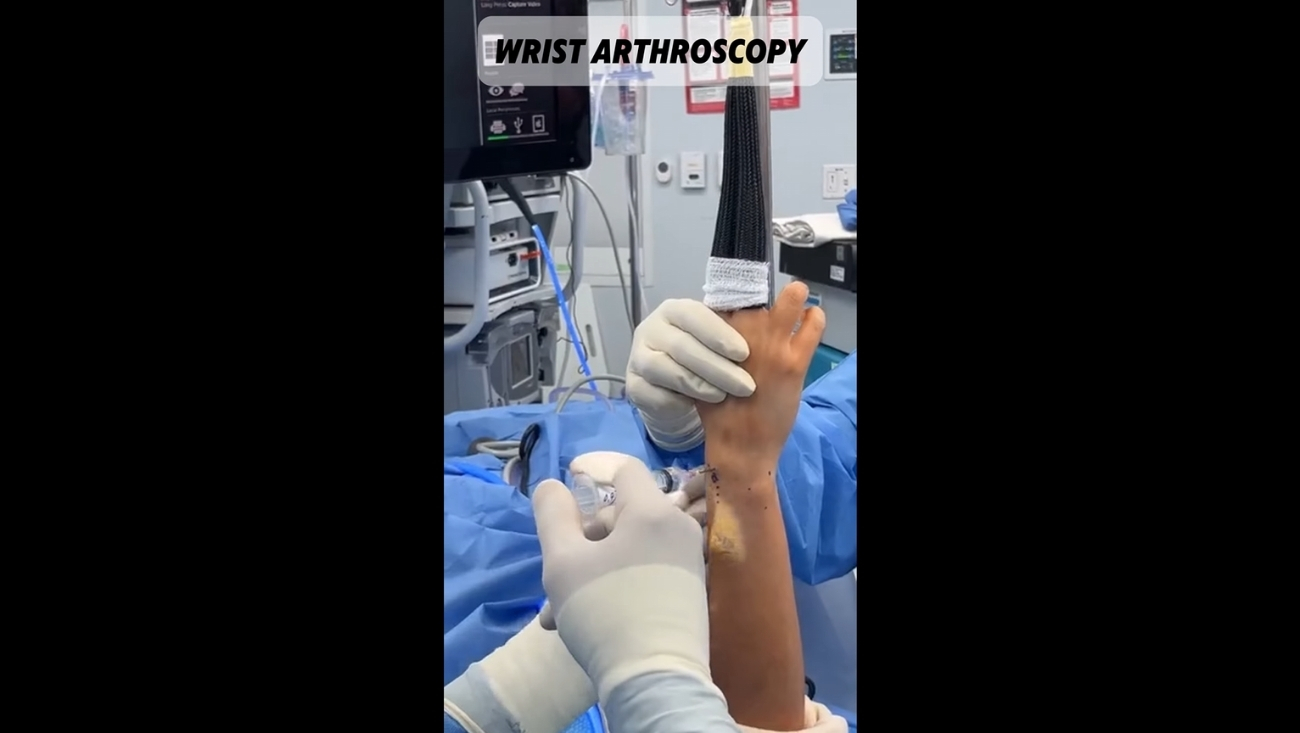 Intraoperative Hand Surgery: Claw Hand Deformity Correction