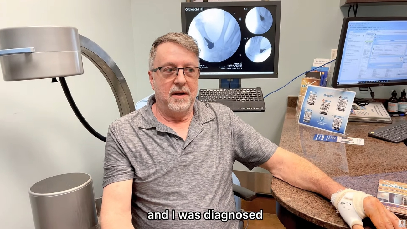 Patient refused traditional LRTI Procedure in GA & found a solution for basal joint arthritis in FL