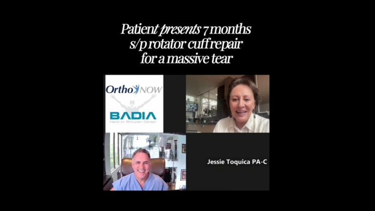 Bursitis Treatment with Growth Factors and PRP in the Shoulder