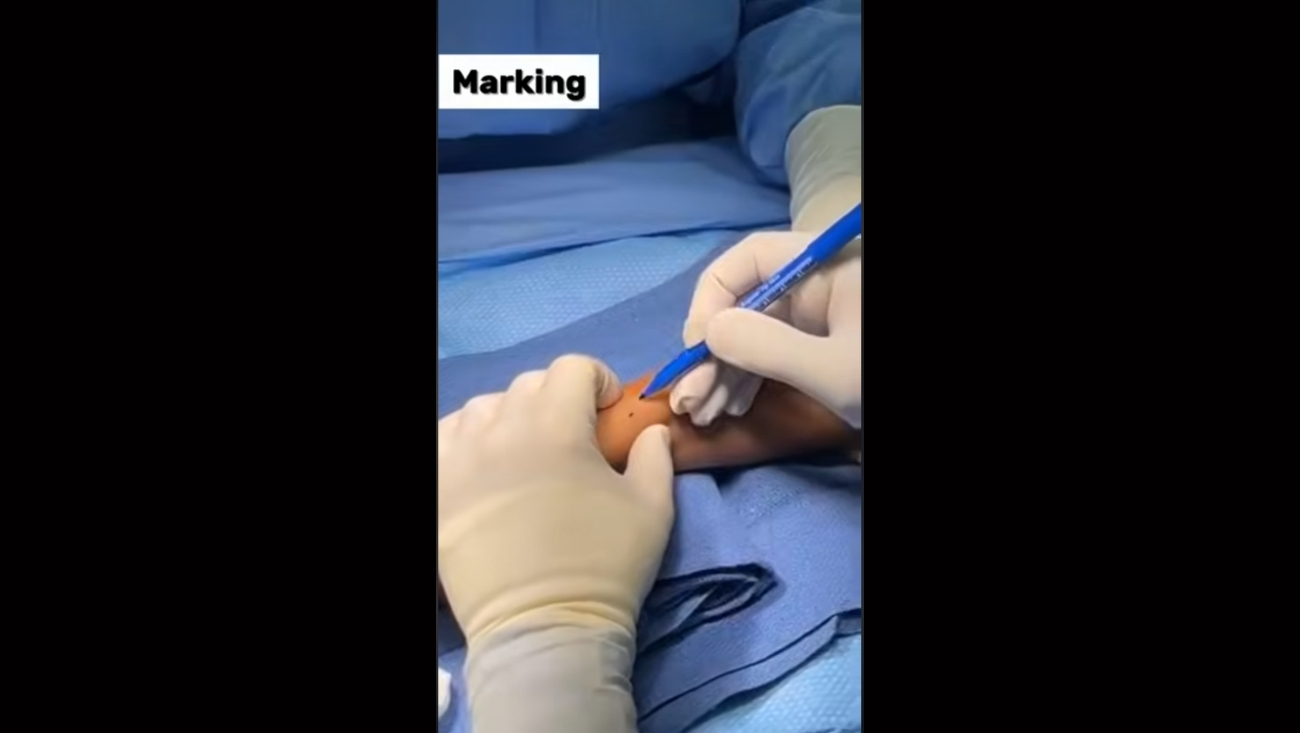 Wrist Pain Pathway: Consultation, Diagnostic Arthroscopy, and Total Wrist Arthroplasty (TWR)