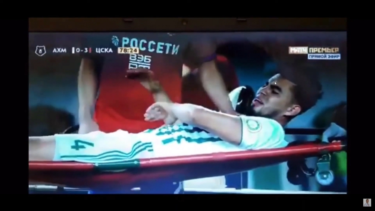 Elbow Injury Wilker Angel Venezuelan Soccer Player Procedure by Dr. Badia