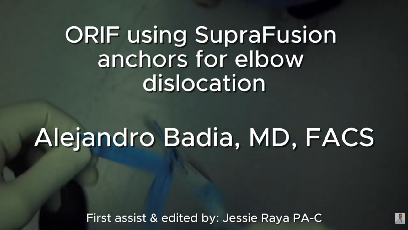 Intraoperative Management of Claw Hand Deformity