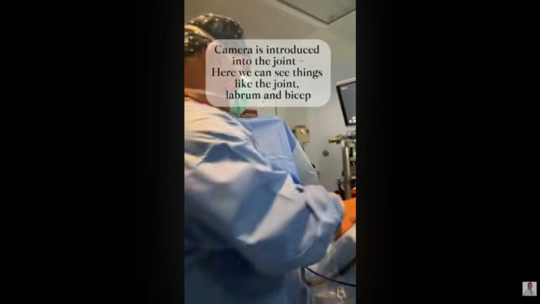 Missing Gaps in Wrist Pain? Dynamic Fluoroscopy for Scapholunate Dissociation