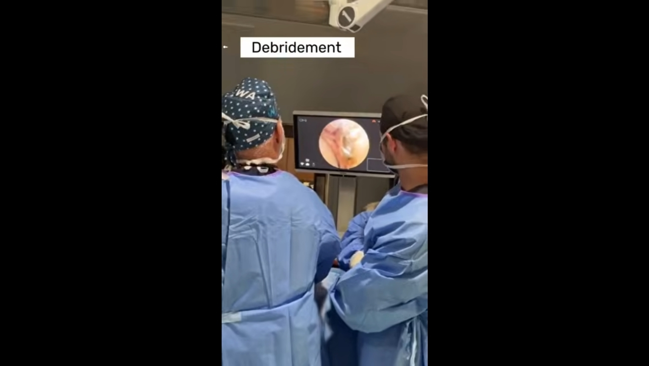 Rotator Cuff Repair with Collagen Patch Augmentation: Advanced Shoulder Surgery