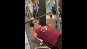 Shoulder replacement: three months after the operation