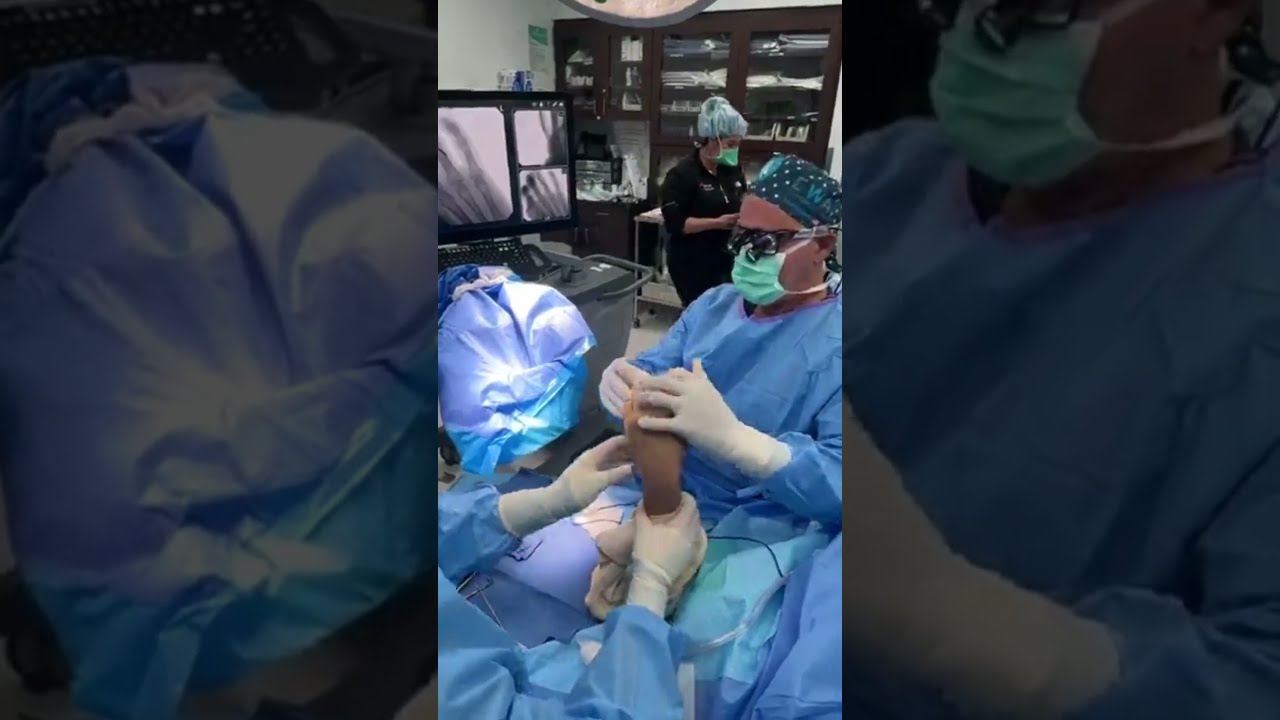 #LivesurgeryTuesday Recap: Central Slip Repair For Boutonnière Deformity