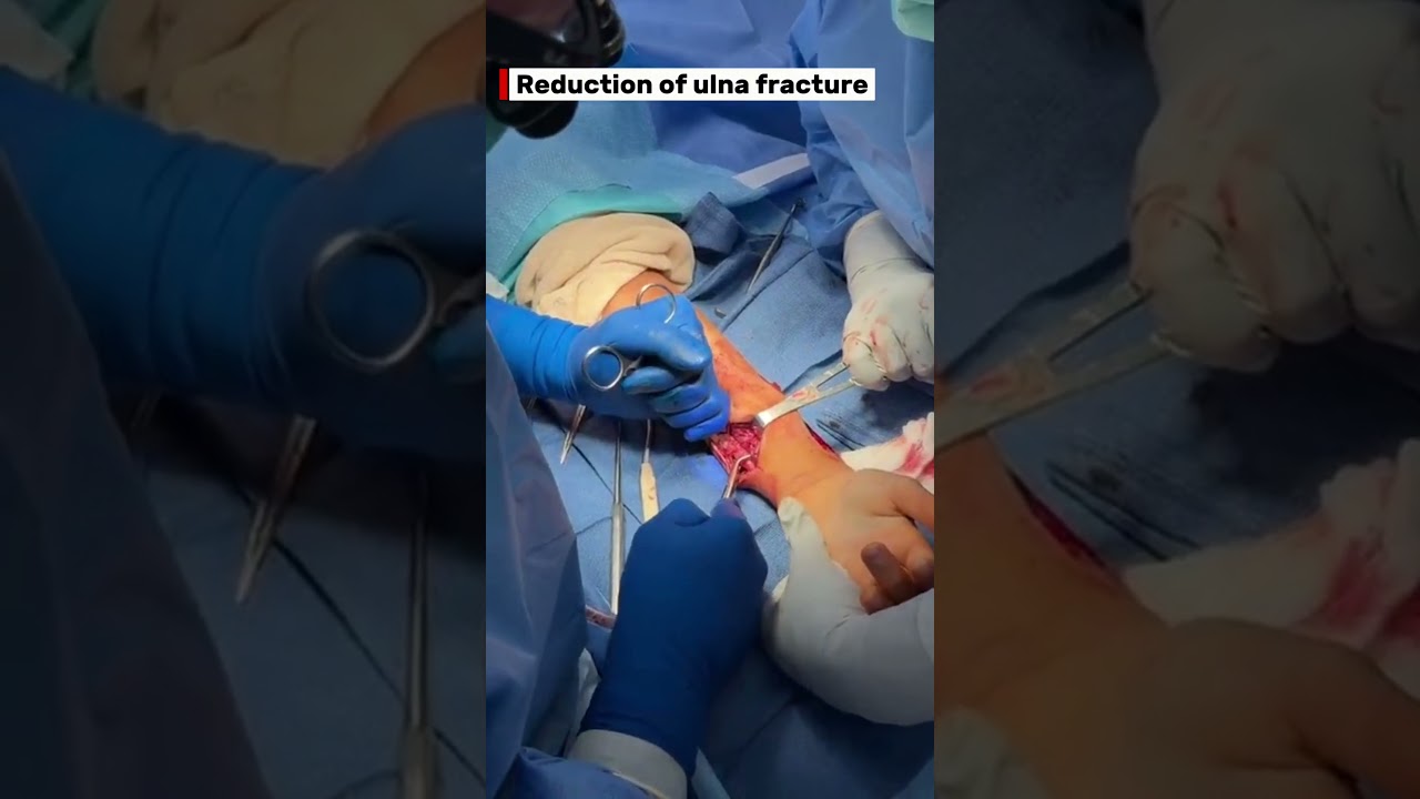 #LiveSurgeryTuesday Recap: ORIF of radius & ulna fracture